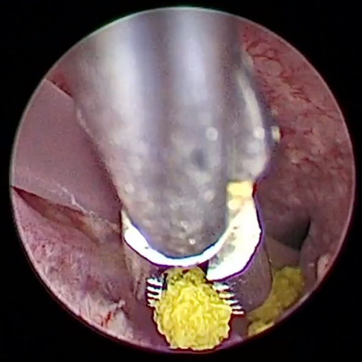 Vierkant-Urologie