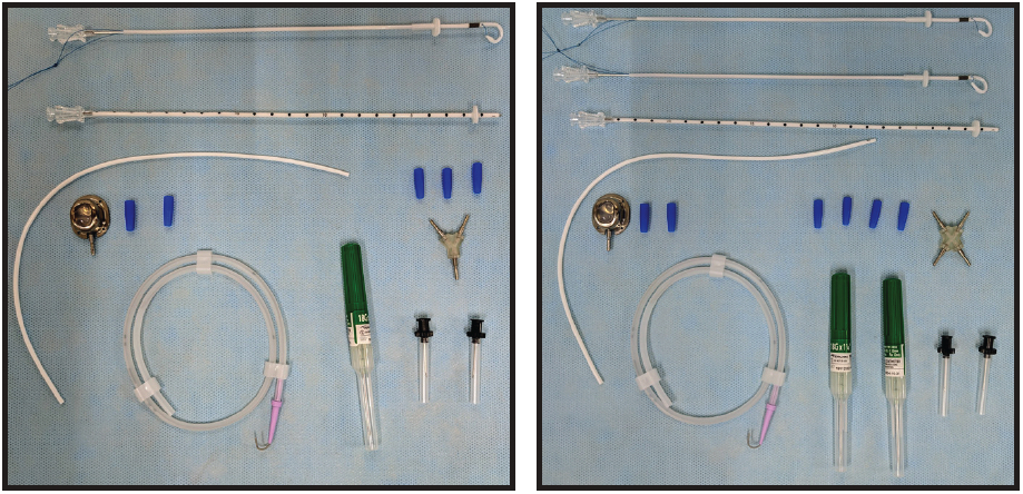 Subcutaneaous ureteral bypass systeem